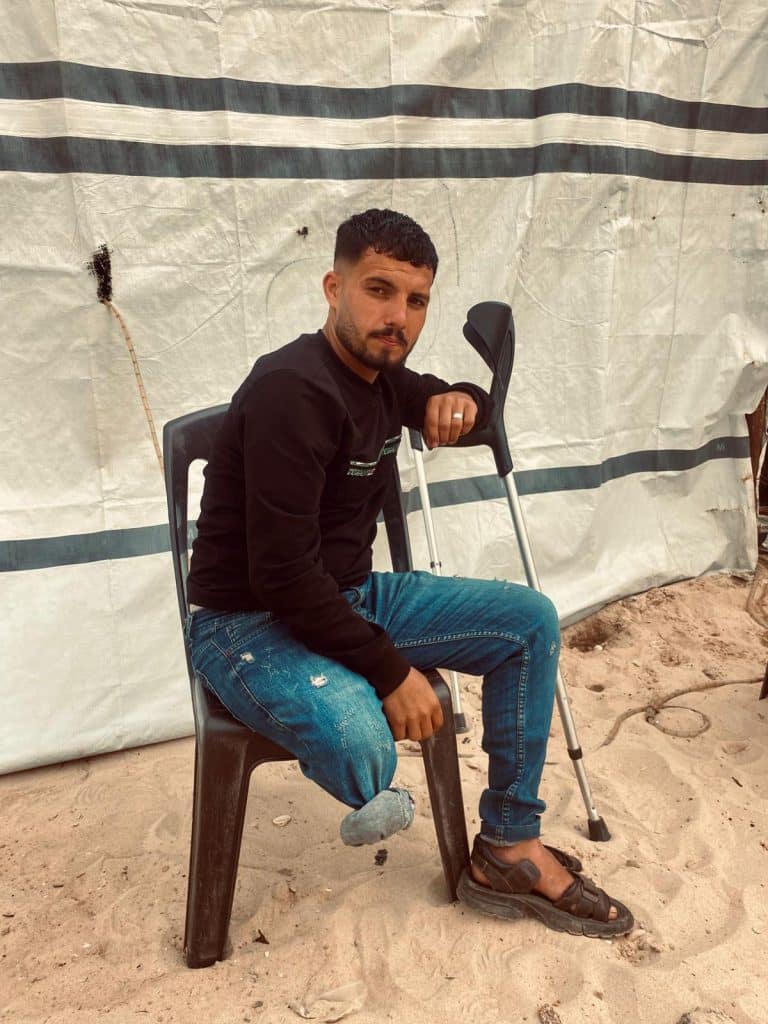 Al-Asmar sits beside a crutch in Al-Mawasi after losing his leg in an Israeli airstrike.

